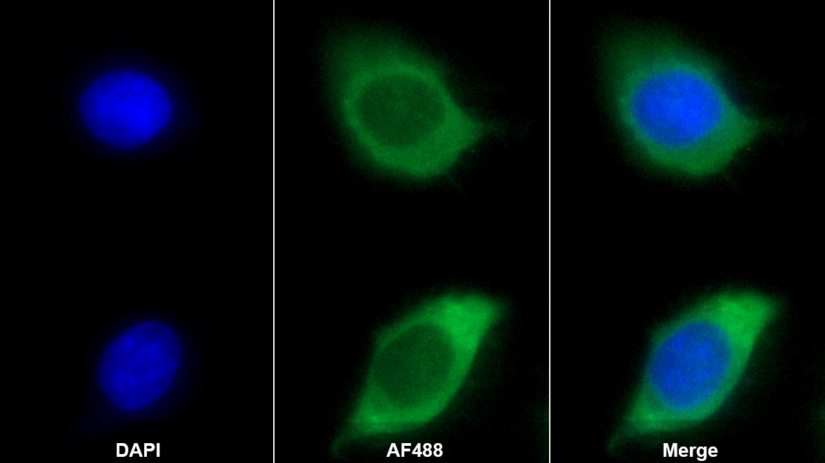 Monoclonal Antibody to Angiopoietin 1 (ANGPT1)