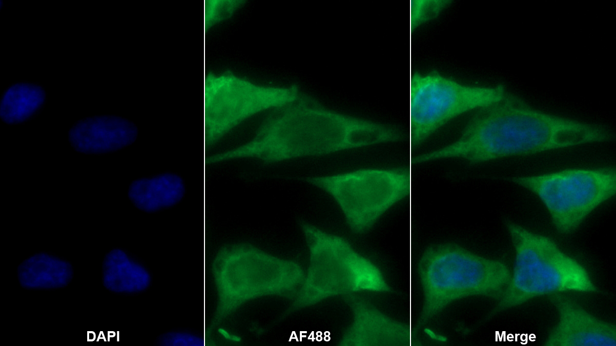 Monoclonal Antibody to Angiopoietin 1 (ANGPT1)