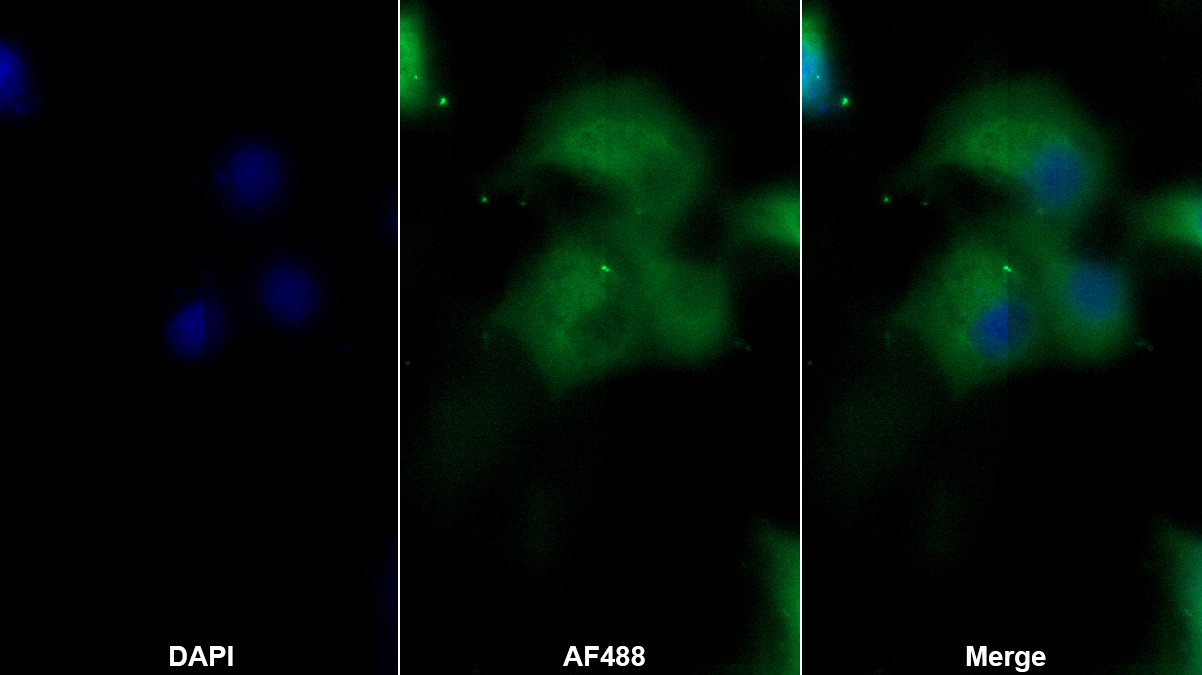 Monoclonal Antibody to Angiopoietin 2 (ANGPT2)