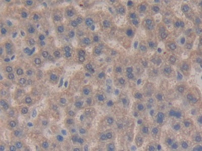 Monoclonal Antibody to Connective Tissue Growth Factor (CTGF)