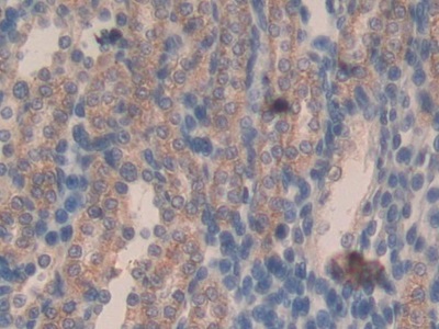 Monoclonal Antibody to Connective Tissue Growth Factor (CTGF)