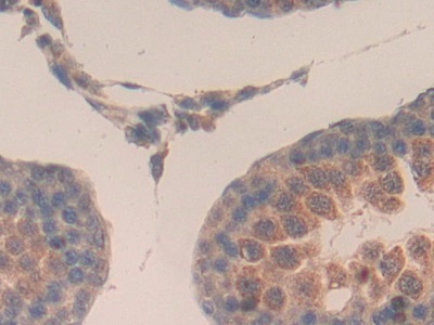 Monoclonal Antibody to Connective Tissue Growth Factor (CTGF)