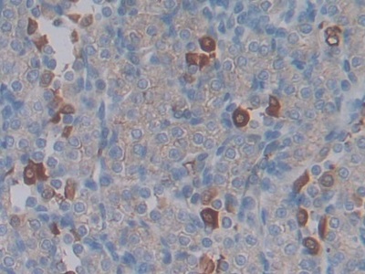 Monoclonal Antibody to Connective Tissue Growth Factor (CTGF)