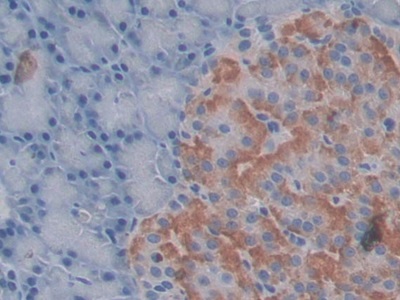 Monoclonal Antibody to Connective Tissue Growth Factor (CTGF)