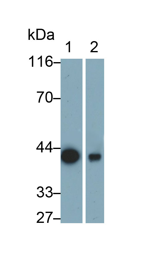 Monoclonal Antibody to Brain Derived Neurotrophic Factor (BDNF)