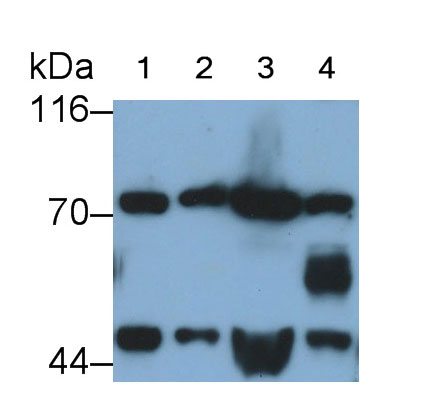 Monoclonal Antibody to Brain Derived Neurotrophic Factor (BDNF)