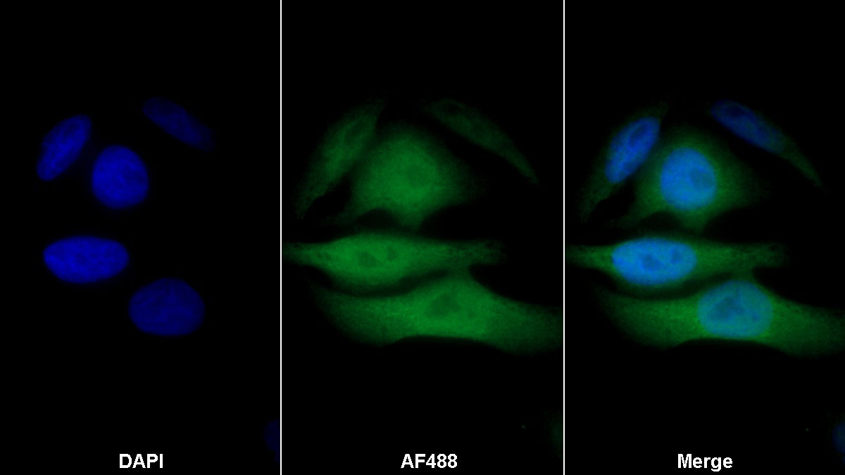 Monoclonal Antibody to S100 Calcium Binding Protein (S100)