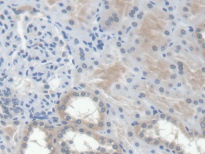 Monoclonal Antibody to Erythropoietin (EPO)