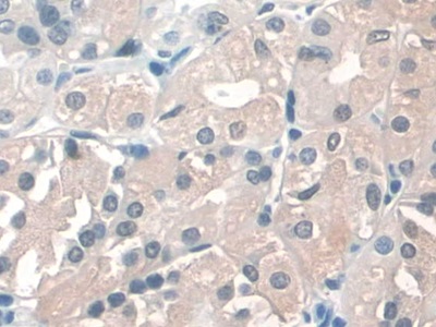 Monoclonal Antibody to Erythropoietin (EPO)