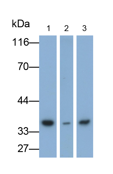 Monoclonal Antibody to Glial Cell Line Derived Neurotrophic Factor (GDNF)