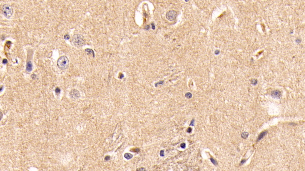 Monoclonal Antibody to Insulin Like Growth Factor 1 (IGF1)