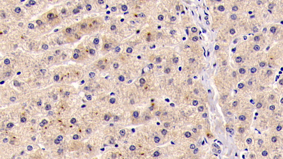 Monoclonal Antibody to Insulin Like Growth Factor 1 (IGF1)