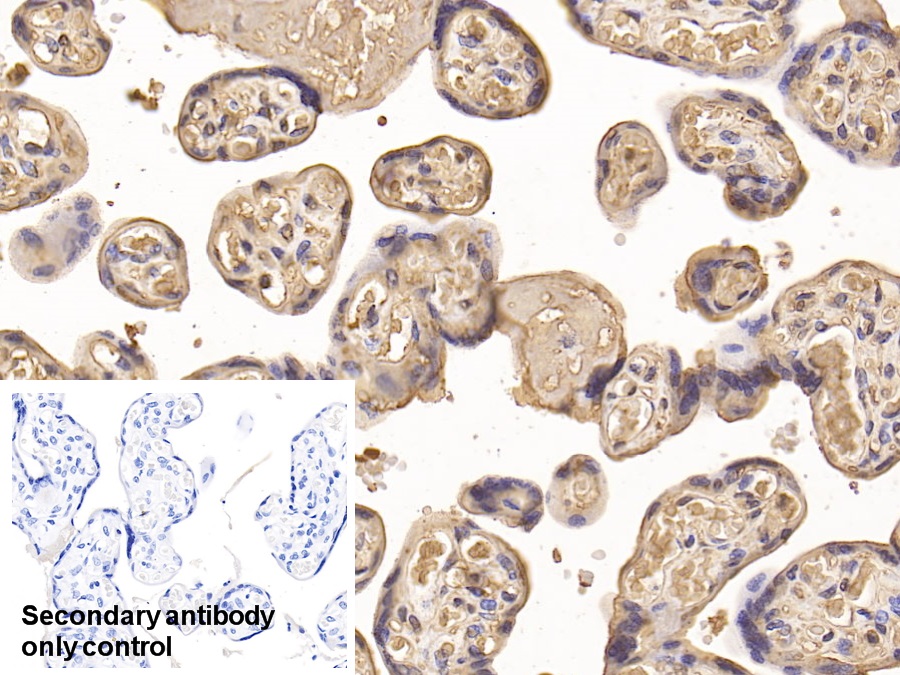 Monoclonal Antibody to Insulin Like Growth Factor Binding Protein 1 (IGFBP1)