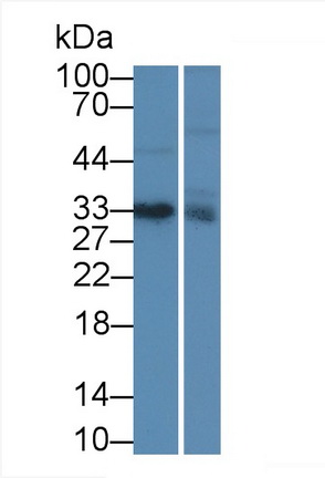 Monoclonal Antibody to Insulin Like Growth Factor Binding Protein 1 (IGFBP1)