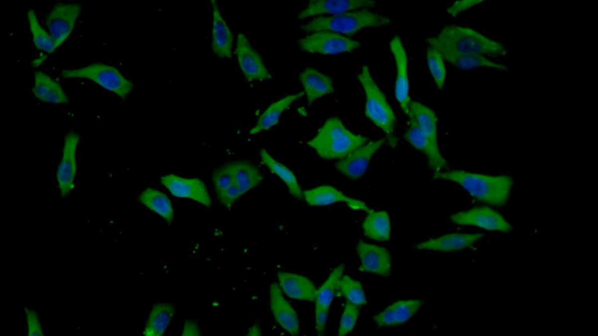 Monoclonal Antibody to Insulin Like Growth Factor Binding Protein 1 (IGFBP1)