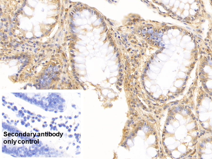 Monoclonal Antibody to Interleukin 17 (IL17)