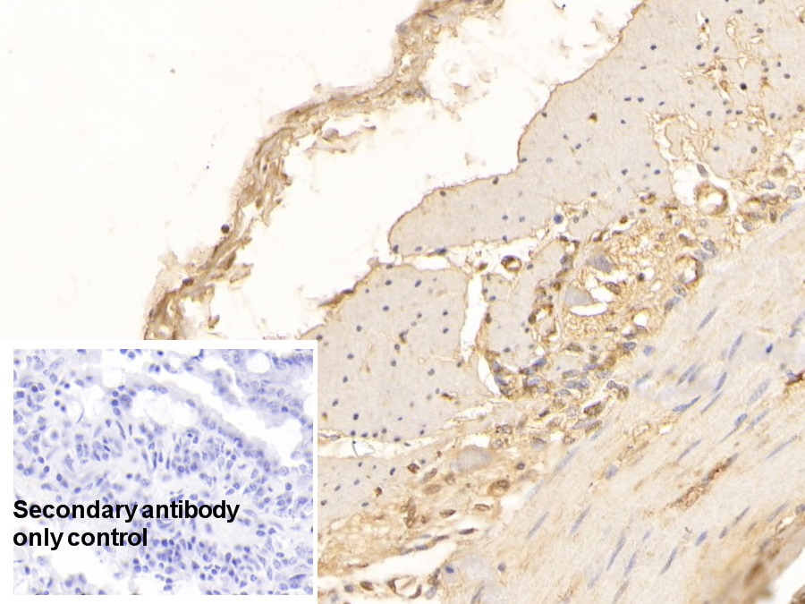 Monoclonal Antibody to Interleukin 17 (IL17)