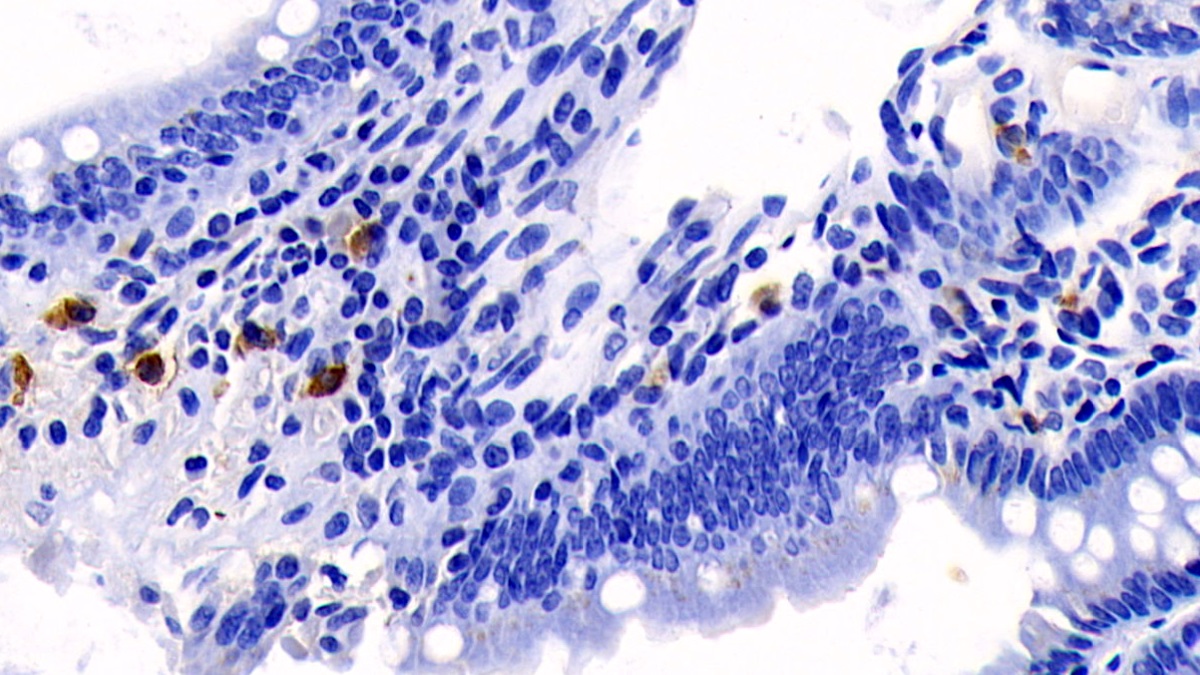 Monoclonal Antibody to Interleukin 17 (IL17)