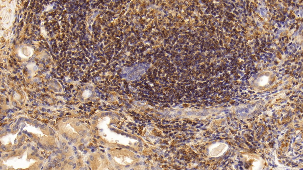 Monoclonal Antibody to Interleukin 17 (IL17)