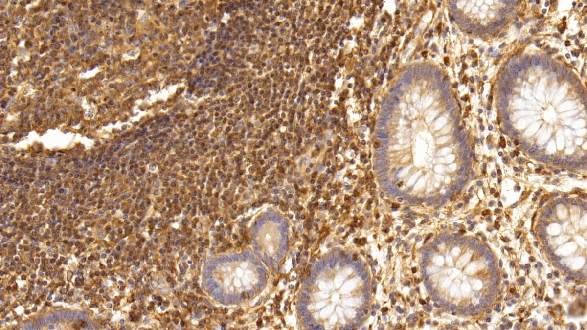 Monoclonal Antibody to Interleukin 17 (IL17)