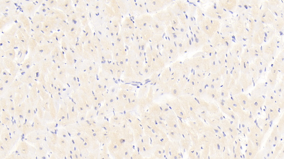 Monoclonal Antibody to Interleukin 18 (IL18)