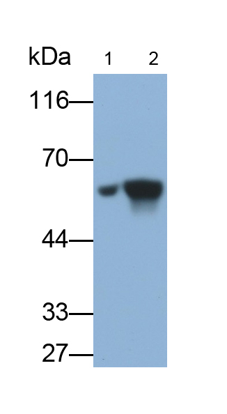 Monoclonal Antibody to Glial Fibrillary Acidic Protein (GFAP)