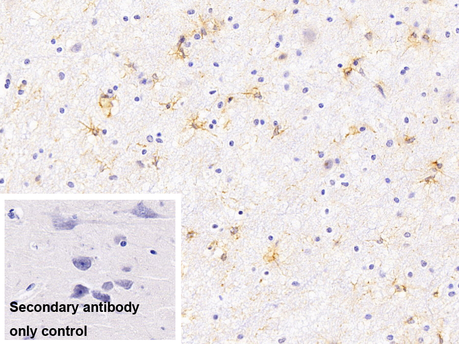 Monoclonal Antibody to Glial Fibrillary Acidic Protein (GFAP)