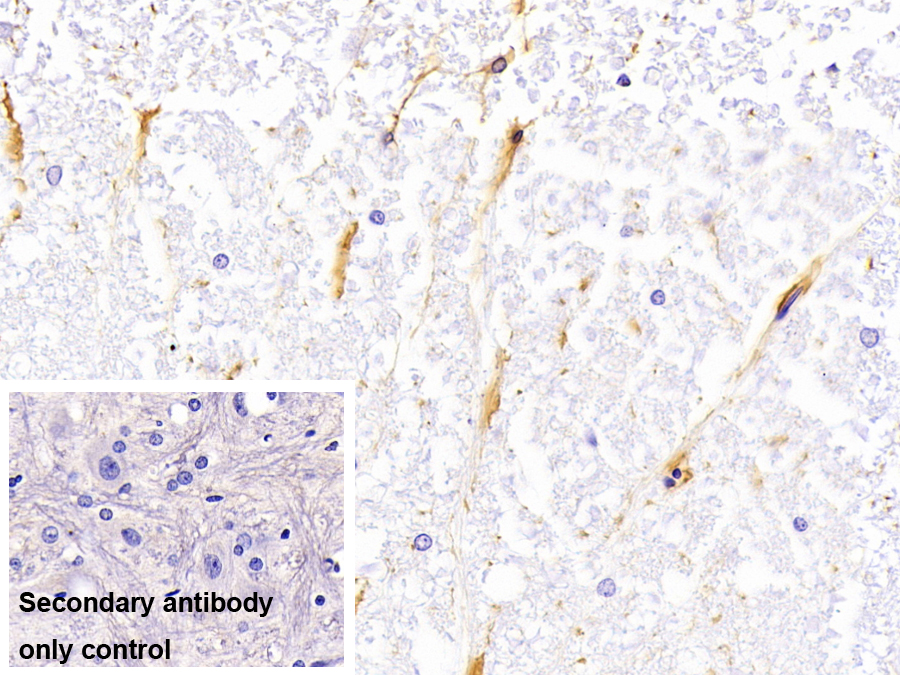 Monoclonal Antibody to Glial Fibrillary Acidic Protein (GFAP)
