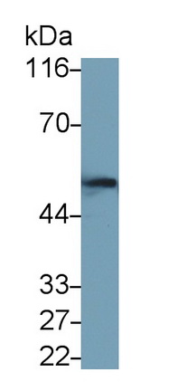 Monoclonal Antibody to Glial Fibrillary Acidic Protein (GFAP)