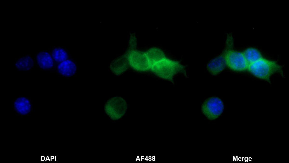 Monoclonal Antibody to Interleukin 1 Alpha (IL1a)