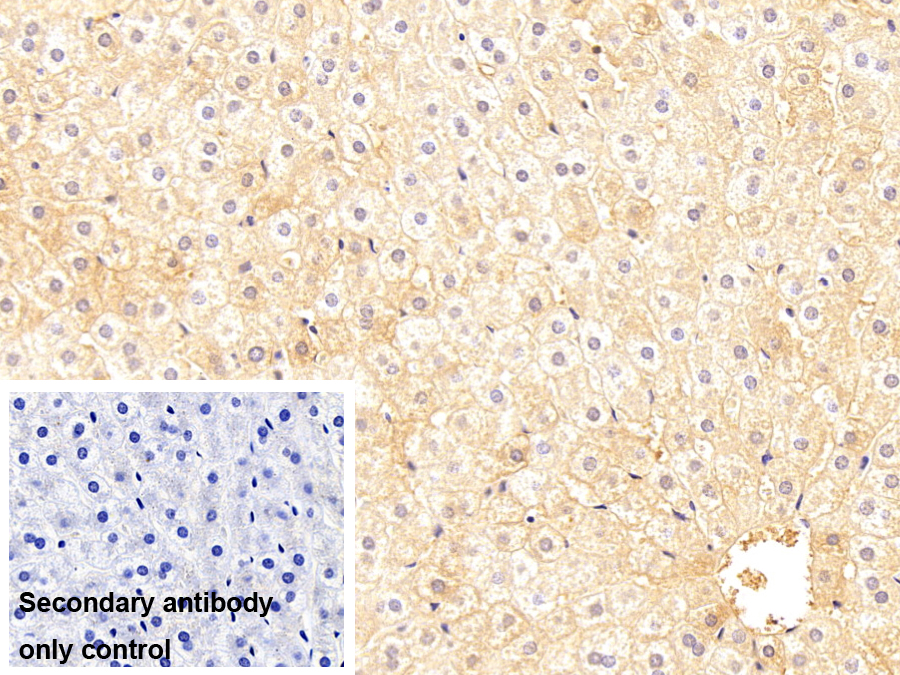 Monoclonal Antibody to Immunoglobulin G1 (IgG1)