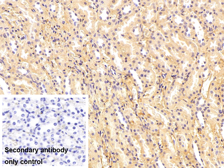 Monoclonal Antibody to Immunoglobulin G1 (IgG1)