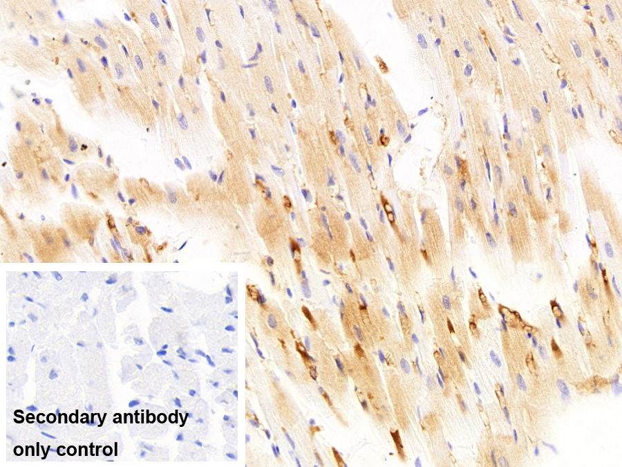 Monoclonal Antibody to Immunoglobulin G1 (IgG1)