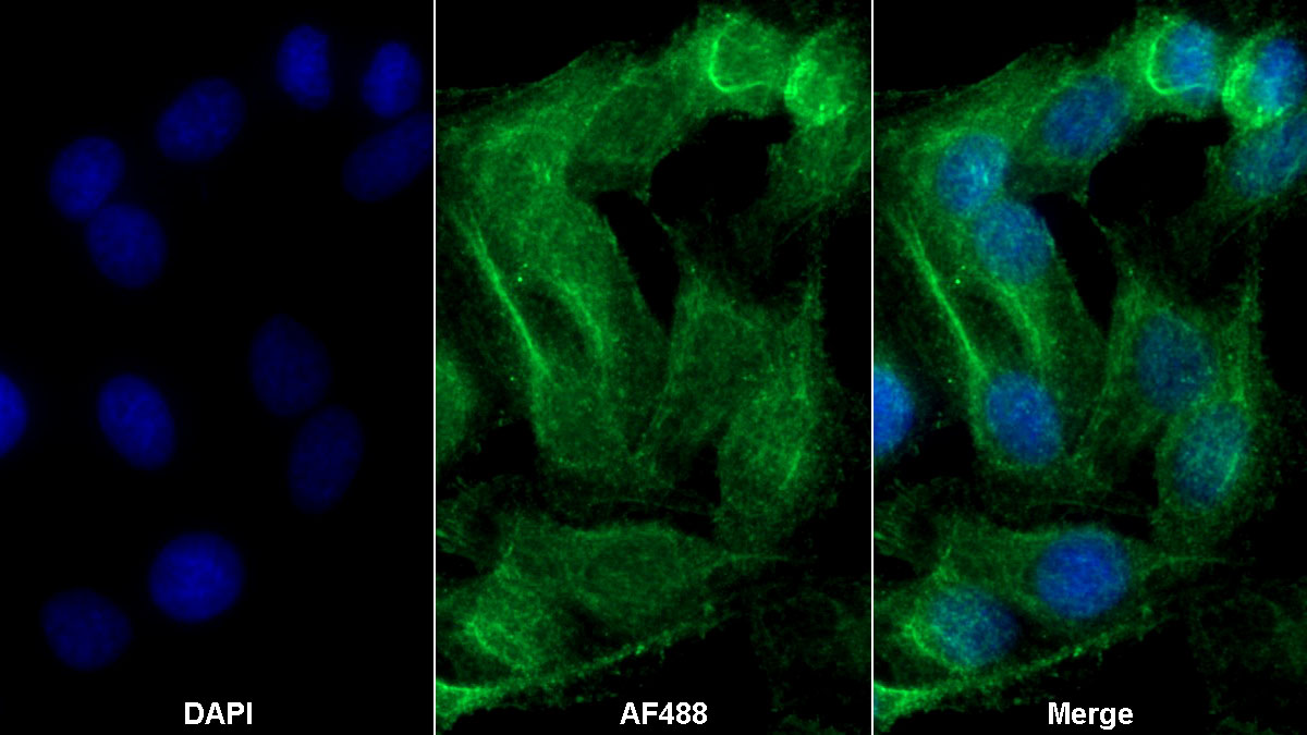 Monoclonal Antibody to Interleukin 6 (IL6)