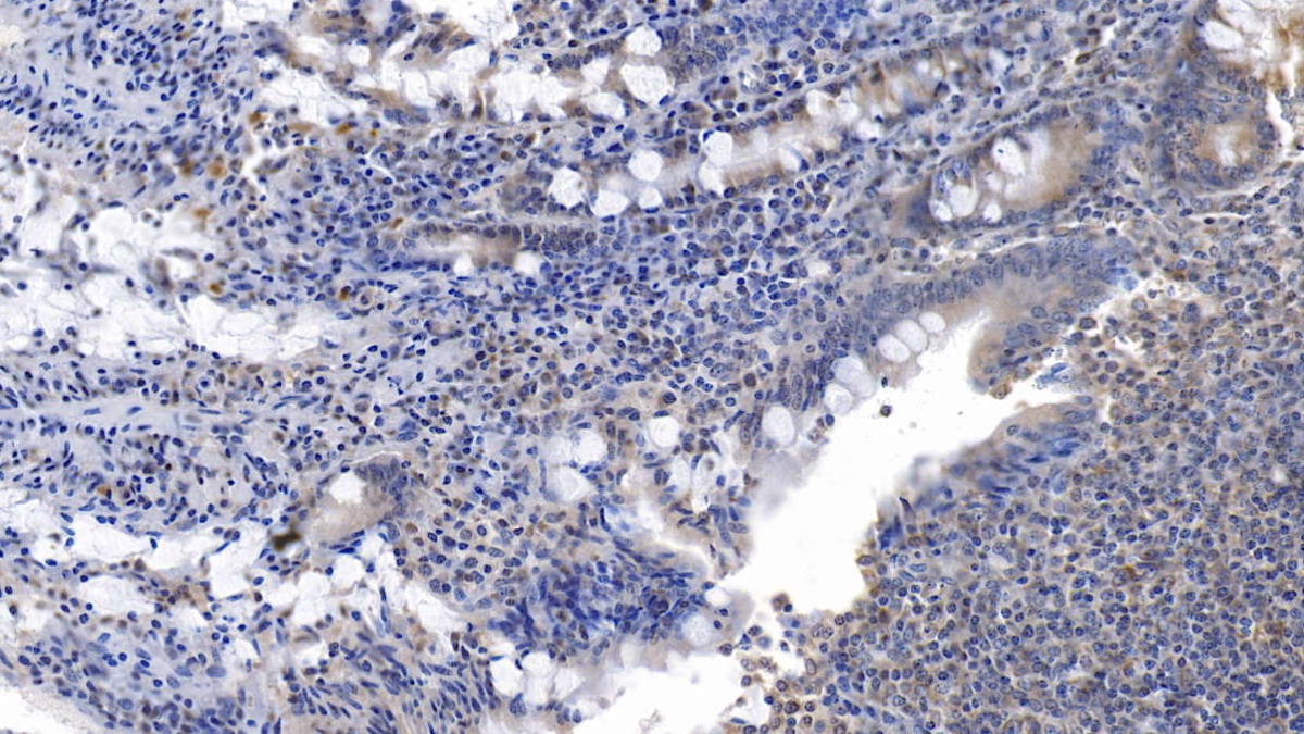 Monoclonal Antibody to Interleukin 6 (IL6)