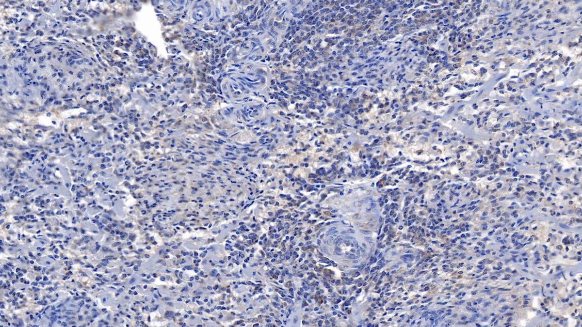 Monoclonal Antibody to Interleukin 6 (IL6)