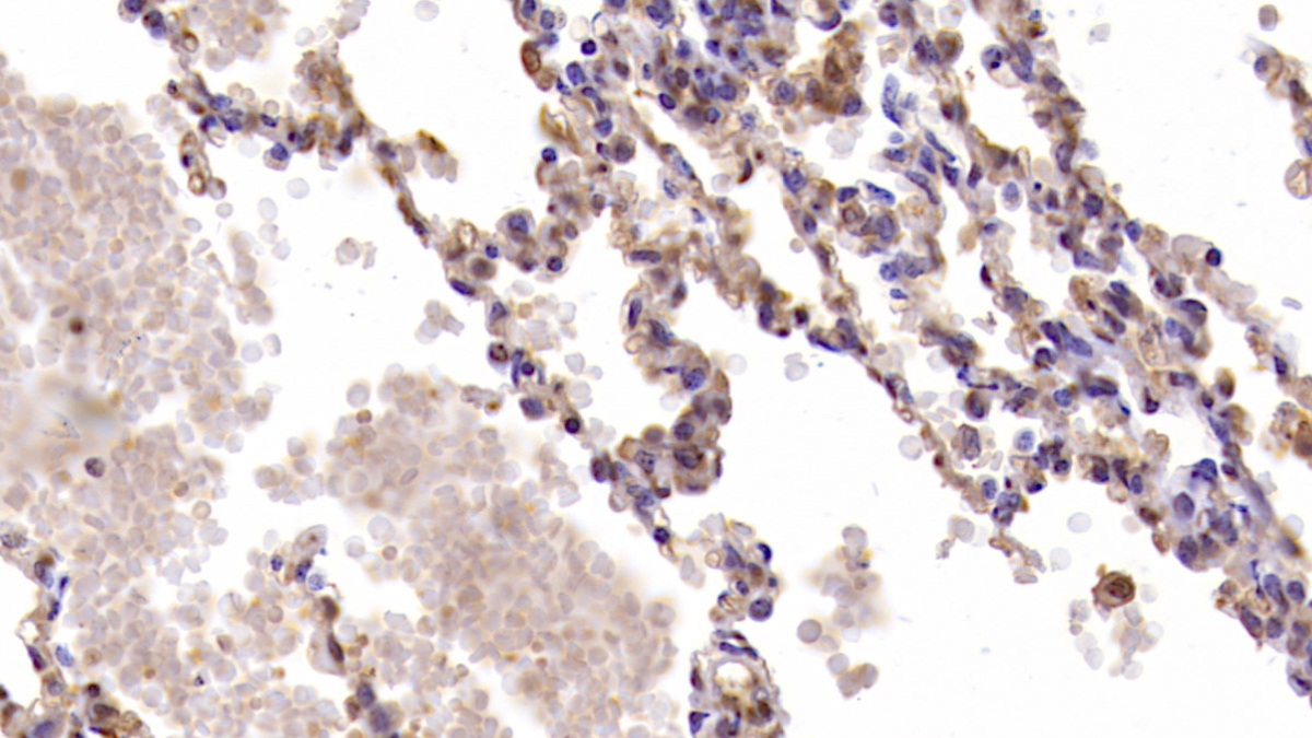 Monoclonal Antibody to Interleukin 6 (IL6)