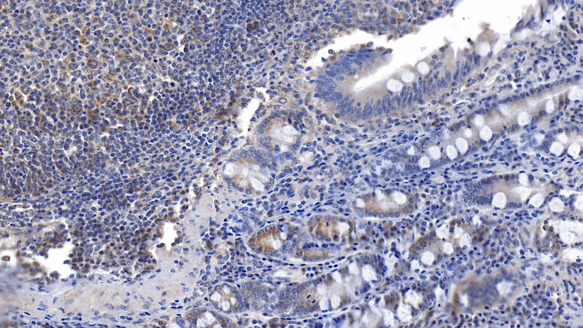 Monoclonal Antibody to Interleukin 6 (IL6)