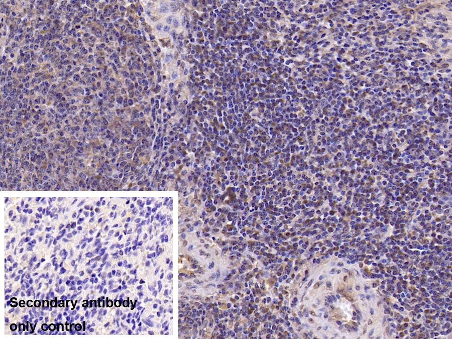 Monoclonal Antibody to Interleukin 6 (IL6)