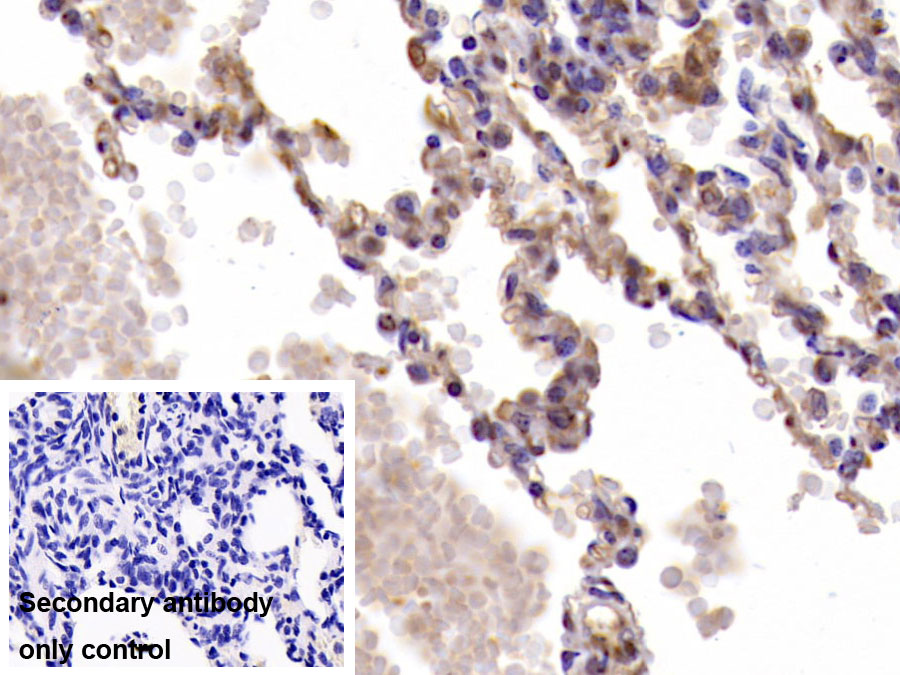 Monoclonal Antibody to Interleukin 6 (IL6)