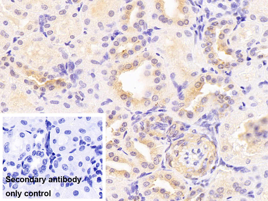 Monoclonal Antibody to Leukemia Inhibitory Factor (LIF)