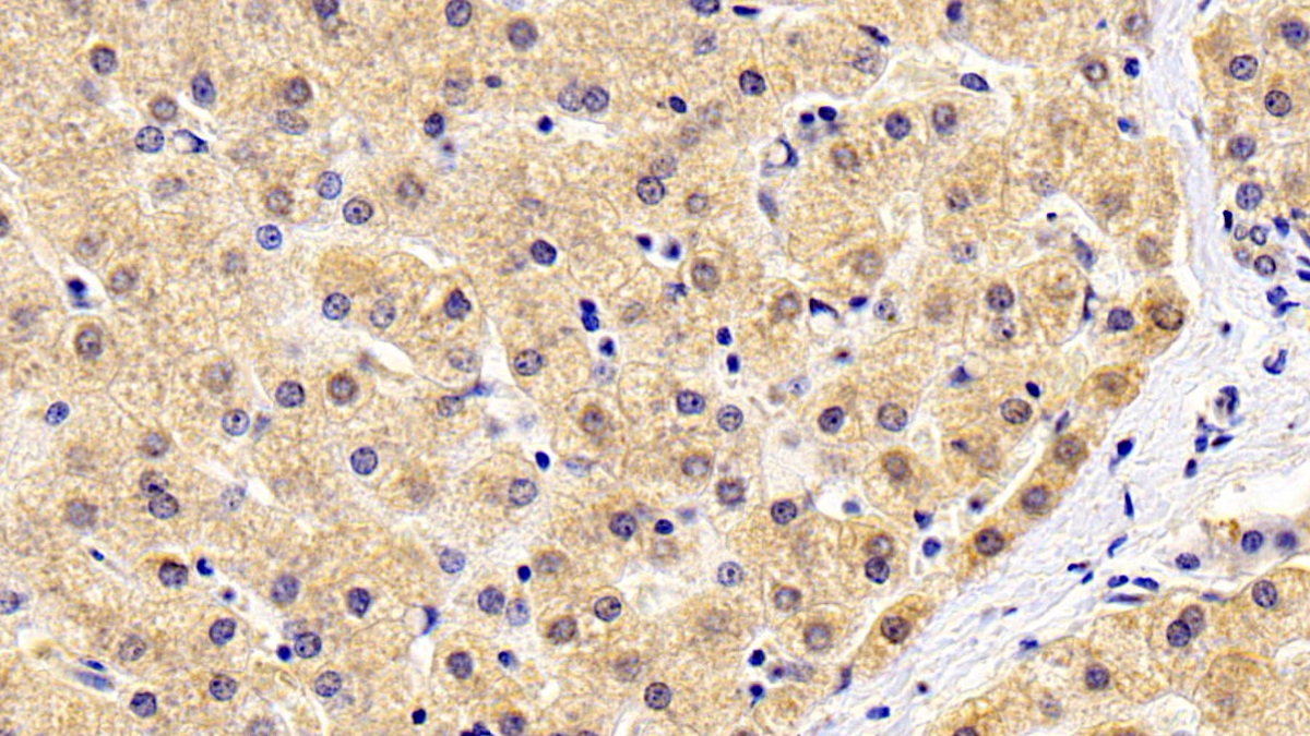 Monoclonal Antibody to Matrix Metalloproteinase 13 (MMP13)