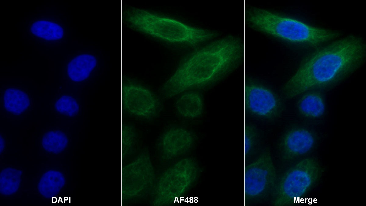 Monoclonal Antibody to Matrix Metalloproteinase 13 (MMP13)