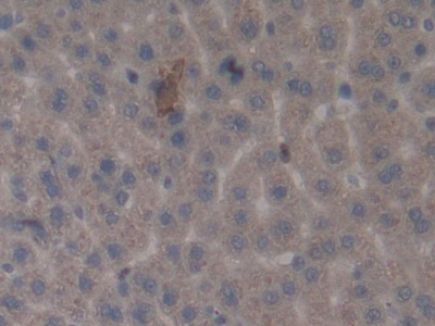 Monoclonal Antibody to Matrix Metalloproteinase 3 (MMP3)