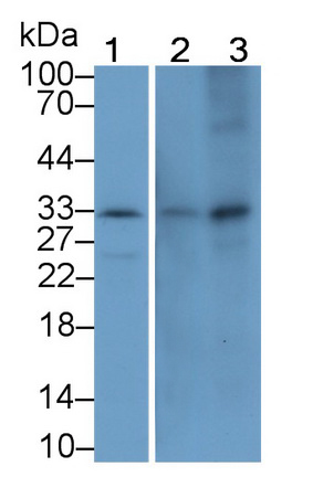 Monoclonal Antibody to Matrix Metalloproteinase 7 (MMP7)