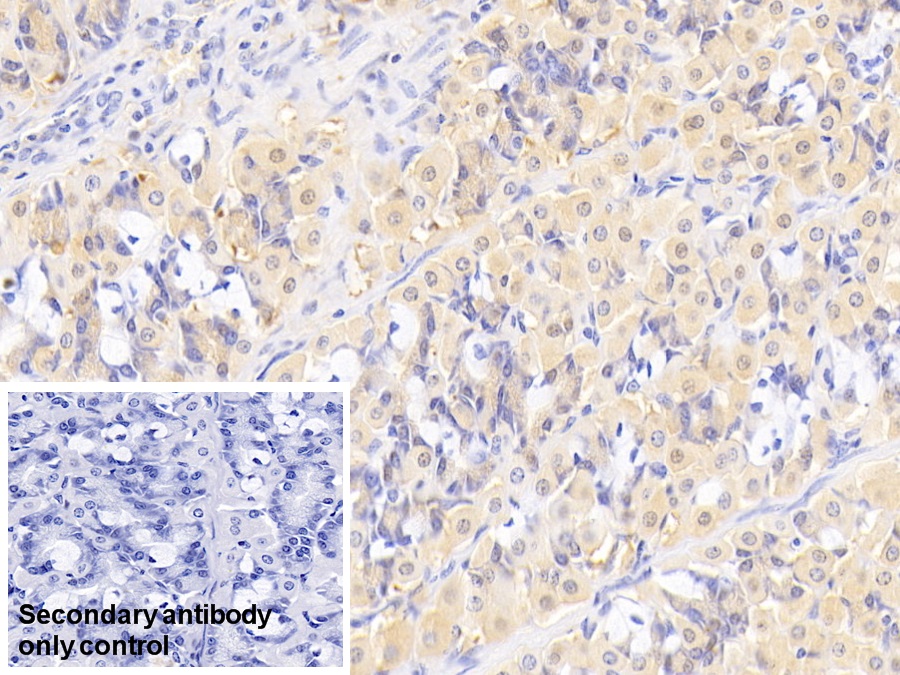 Monoclonal Antibody to Matrix Metalloproteinase 7 (MMP7)