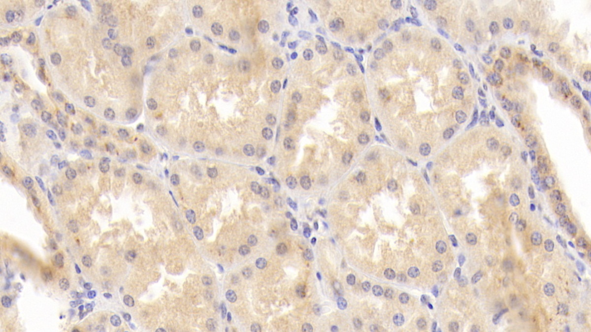 Monoclonal Antibody to Matrix Metalloproteinase 7 (MMP7)