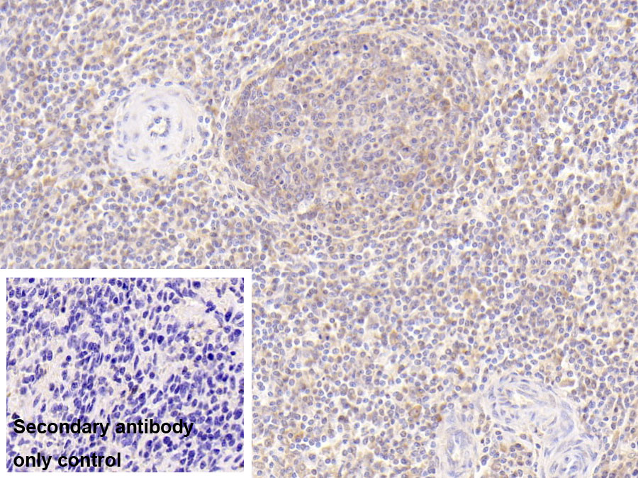 Monoclonal Antibody to Matrix Metalloproteinase 7 (MMP7)