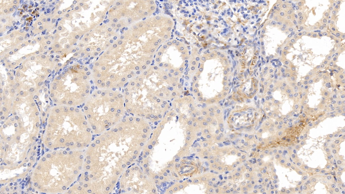 Monoclonal Antibody to Matrix Metalloproteinase 8 (MMP8)