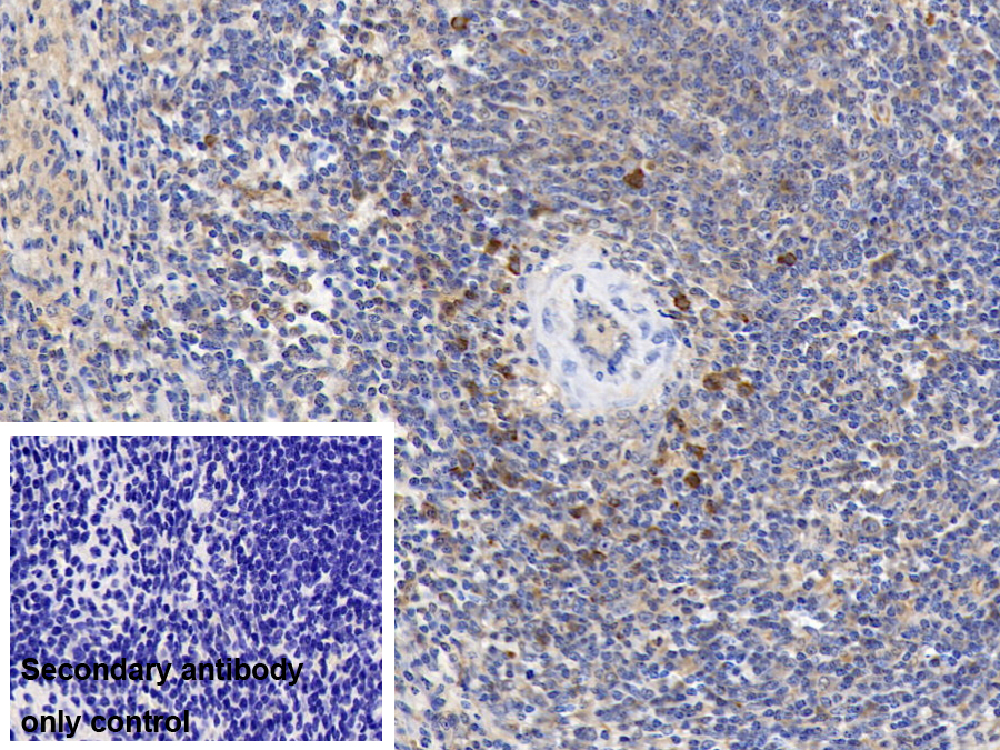 Monoclonal Antibody to Matrix Metalloproteinase 8 (MMP8)